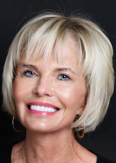 female smiling patient after Smile Makeover