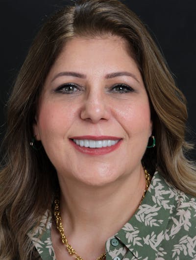 FloridasSmiles Gum Lifting Gallery patient