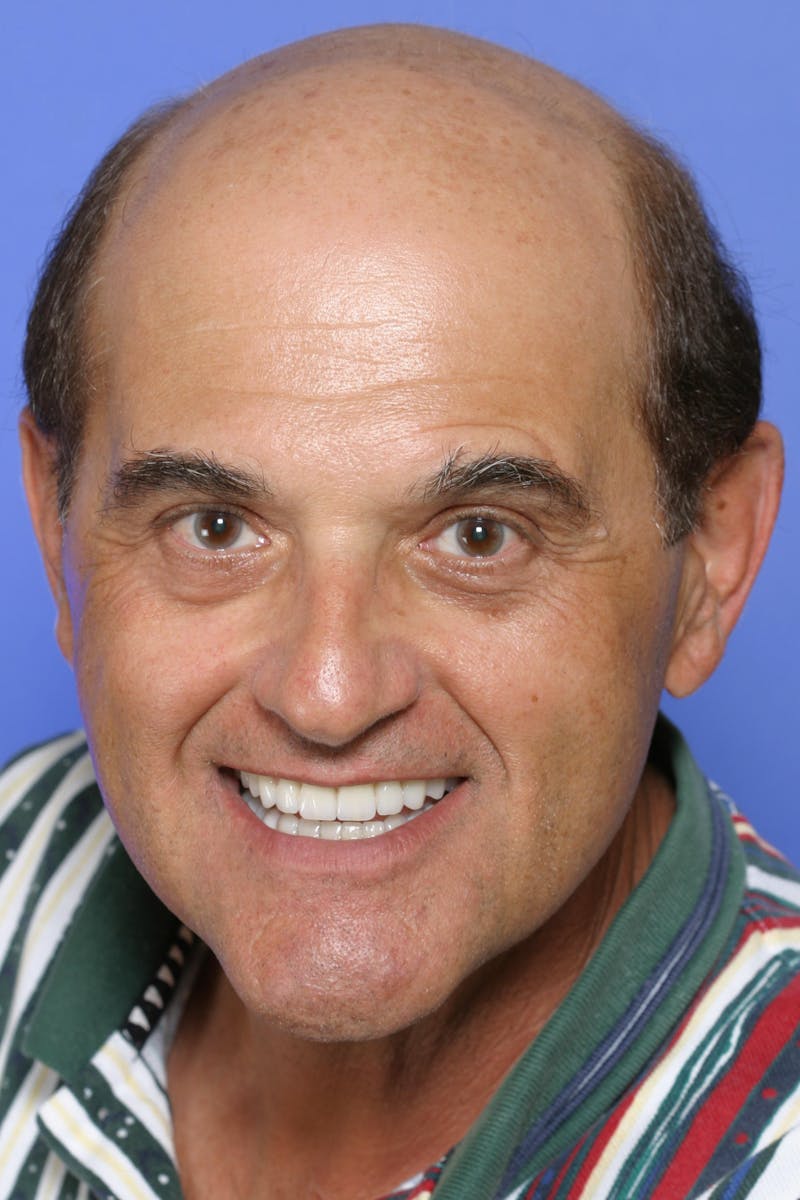 FloridasSmiles Smile Gallery patient