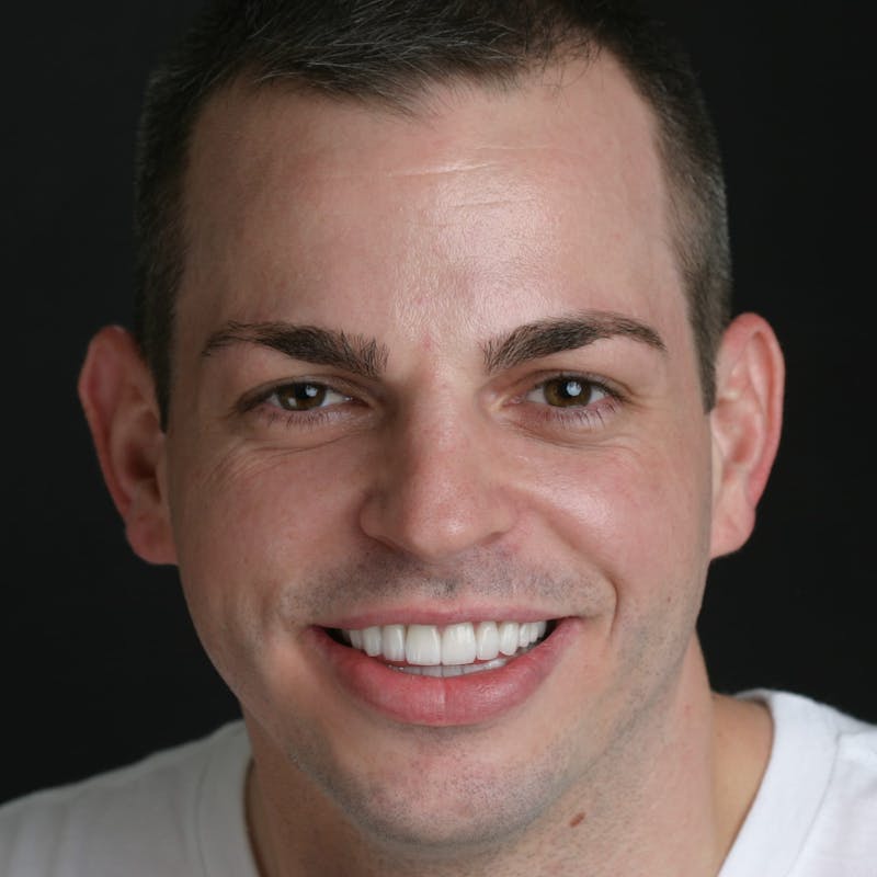 FloridasSmiles Smile Gallery patient