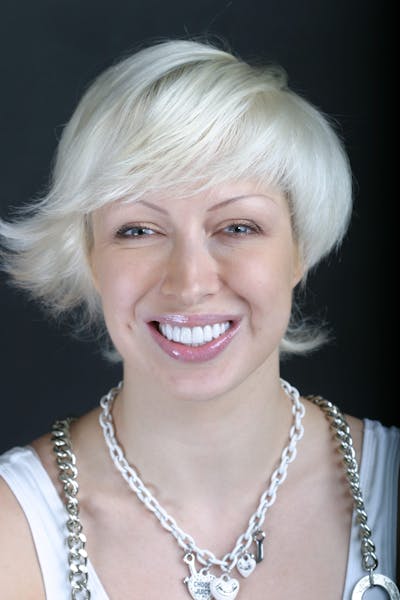 FloridasSmiles Smile Makeover Gallery patient