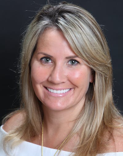 FloridasSmiles Porcelain Veneers Gallery patient