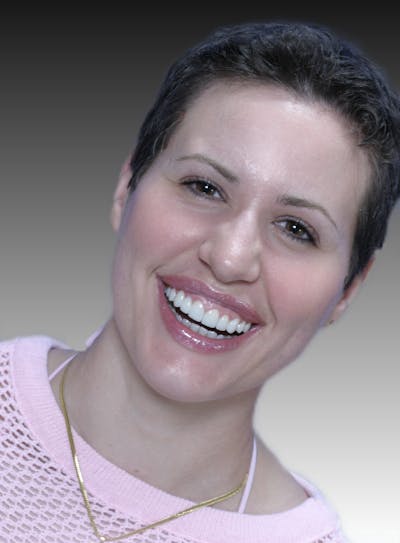 FloridasSmiles Porcelain Veneers Gallery patient