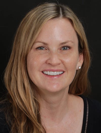 FloridasSmiles Smile Makeover Gallery patient