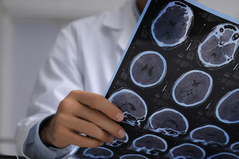 A doctor holding brain scans