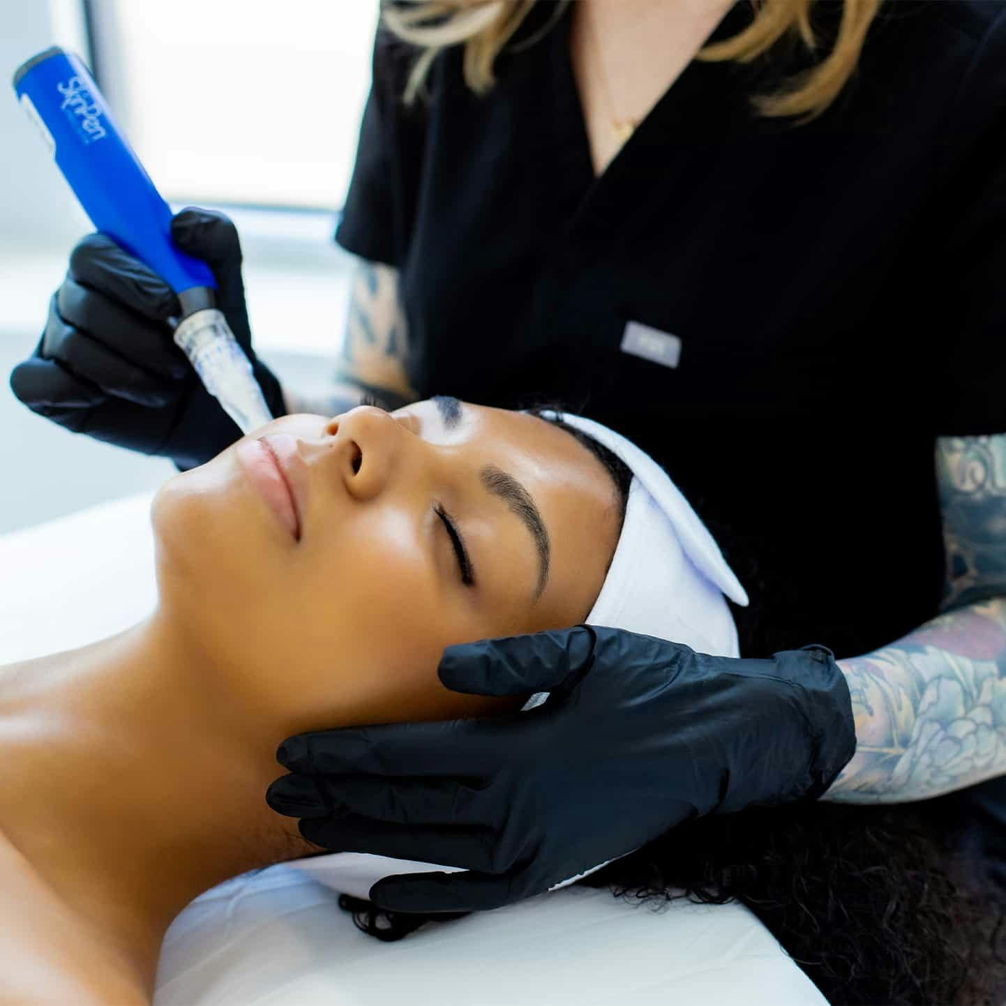 Woman during skinpen treatment