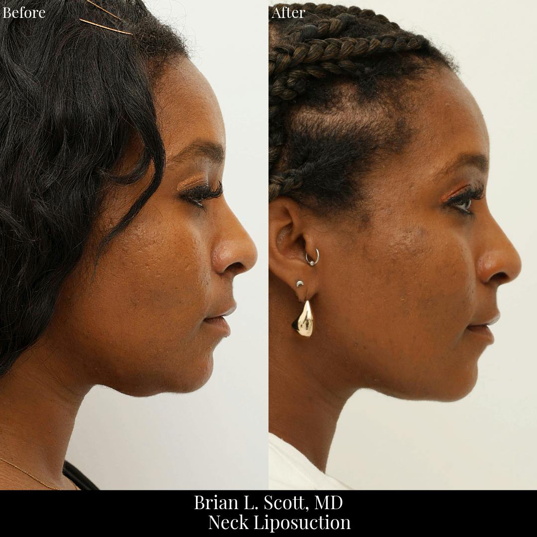 procedure