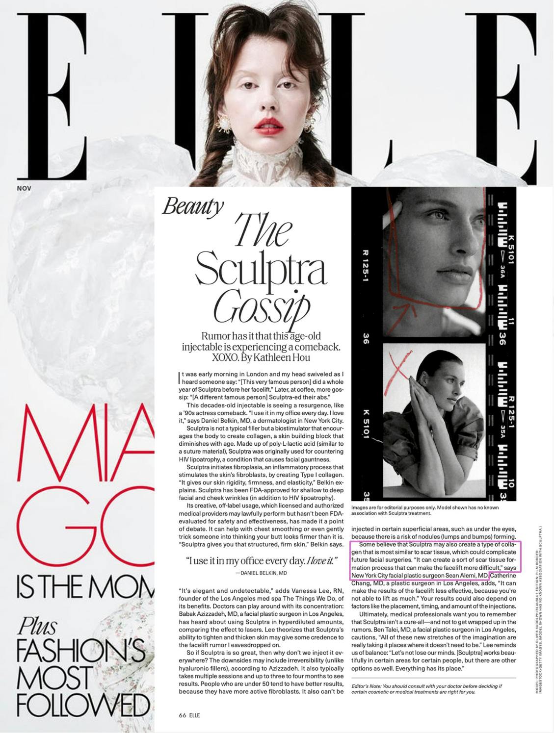 Dr. Alemi featured in Elle