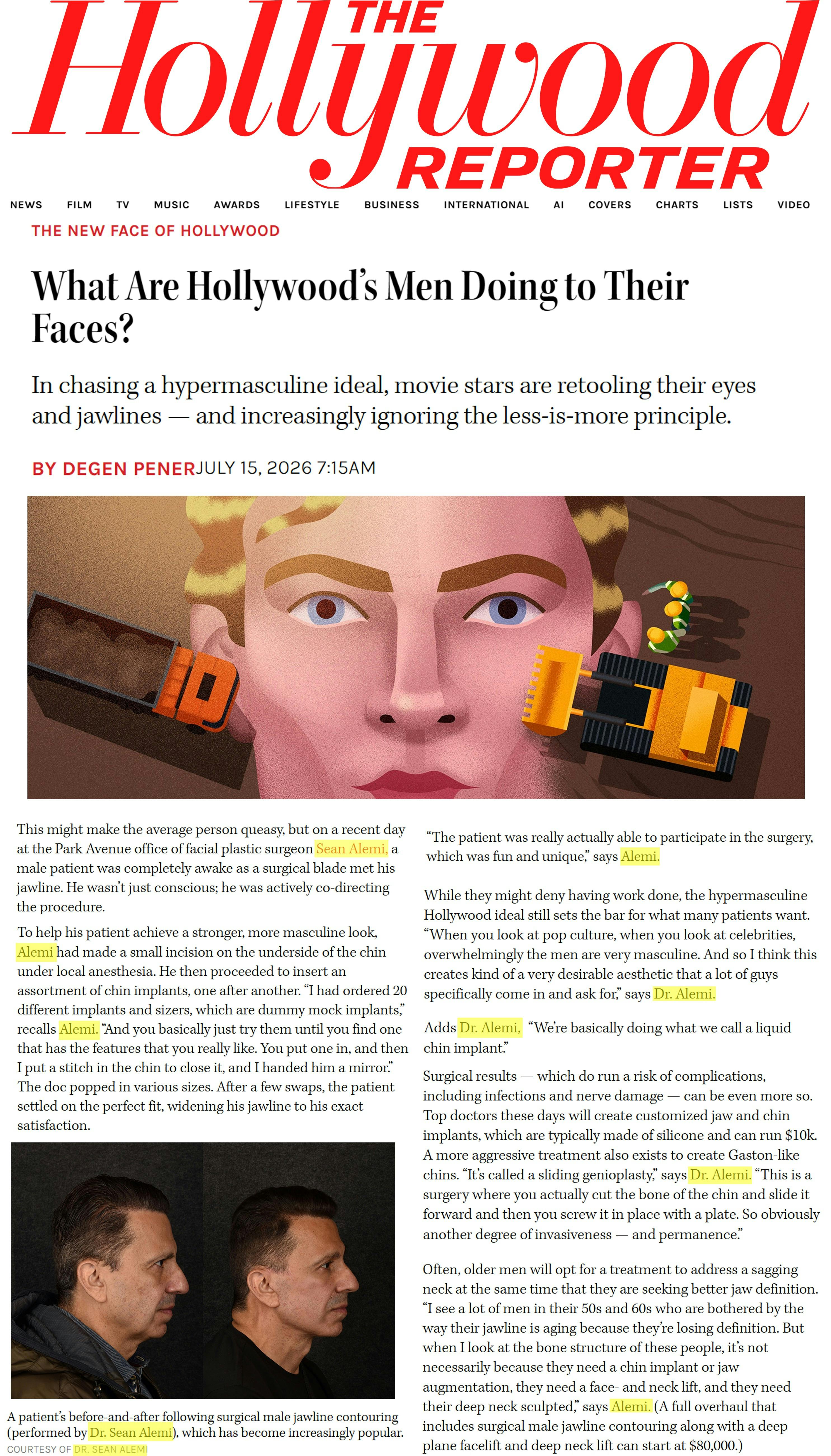 What Are Hollywood’s Men Doing to Their Faces?