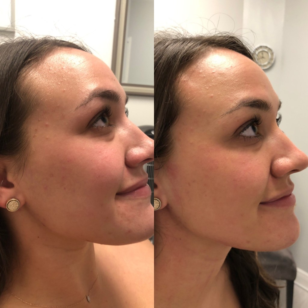 patient results