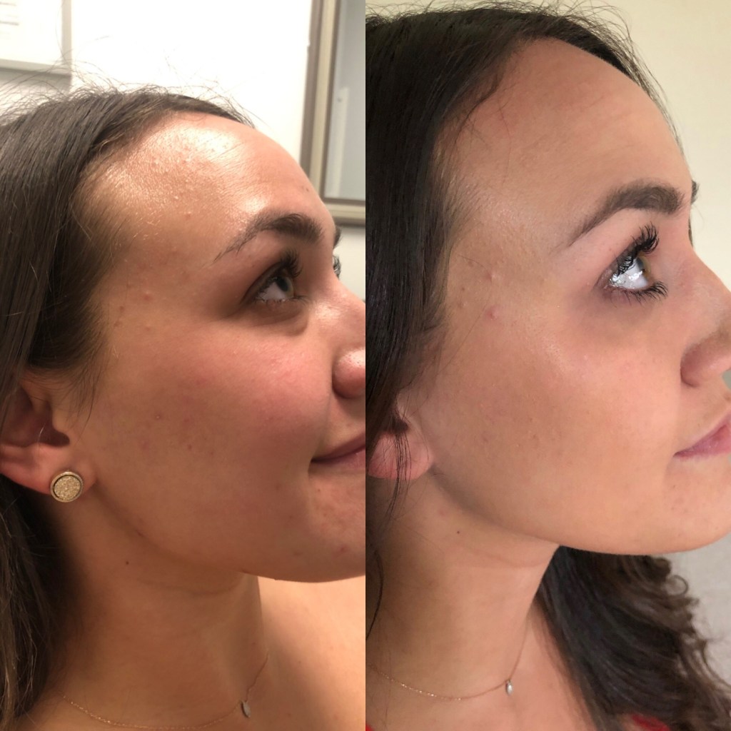 patient results
