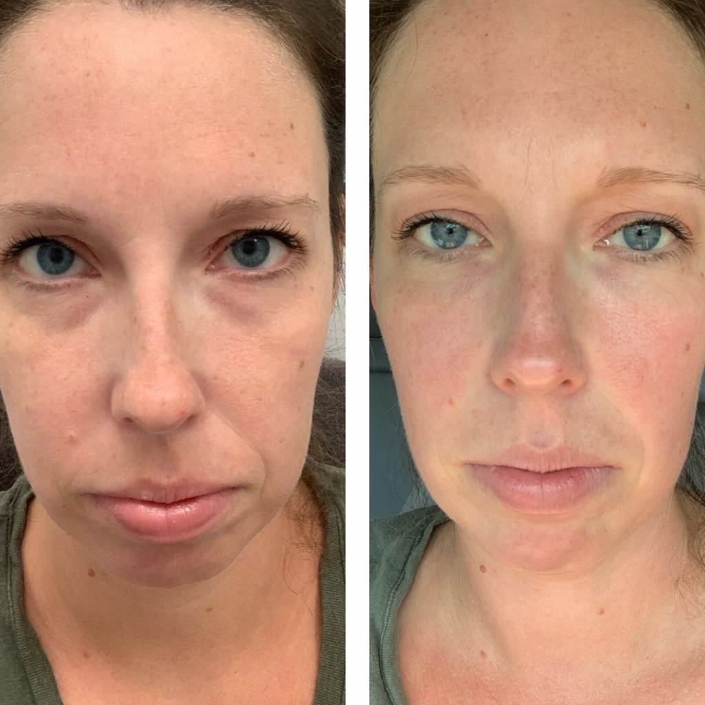 patient's results