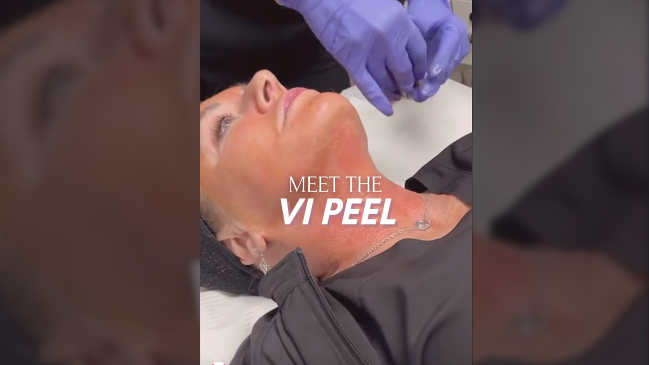 Meet VI Peel