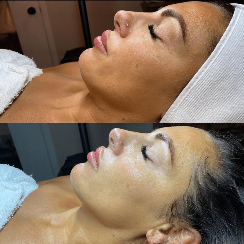 Guide to Facial Massage: Benefits & Step-By-Step Techniques