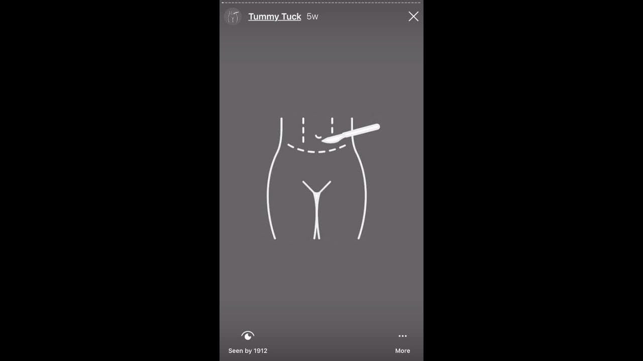 Colorado Plastic Surgery Center