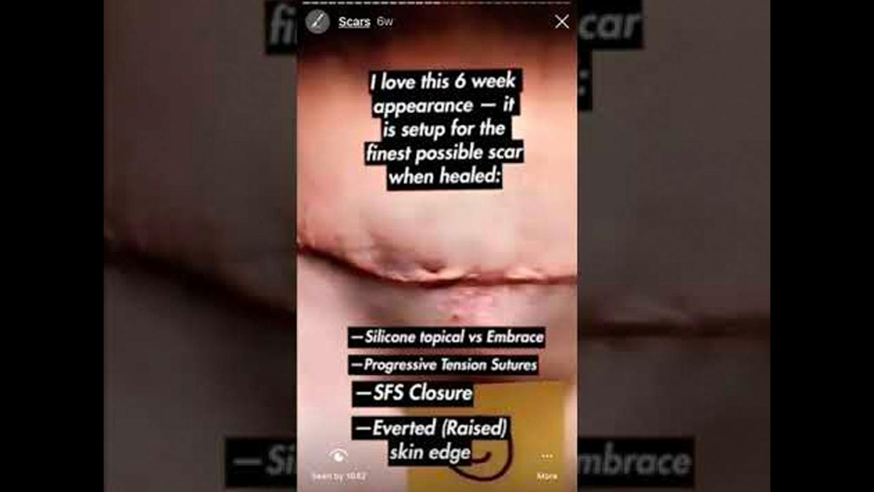 Colorado Plastic Surgery Center