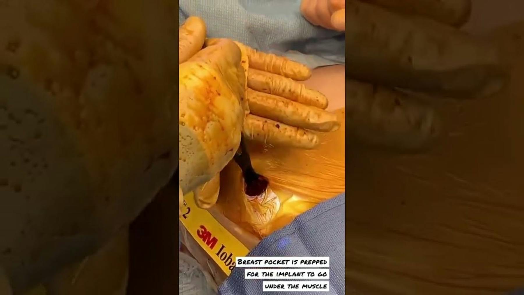 Colorado Plastic Surgery Center