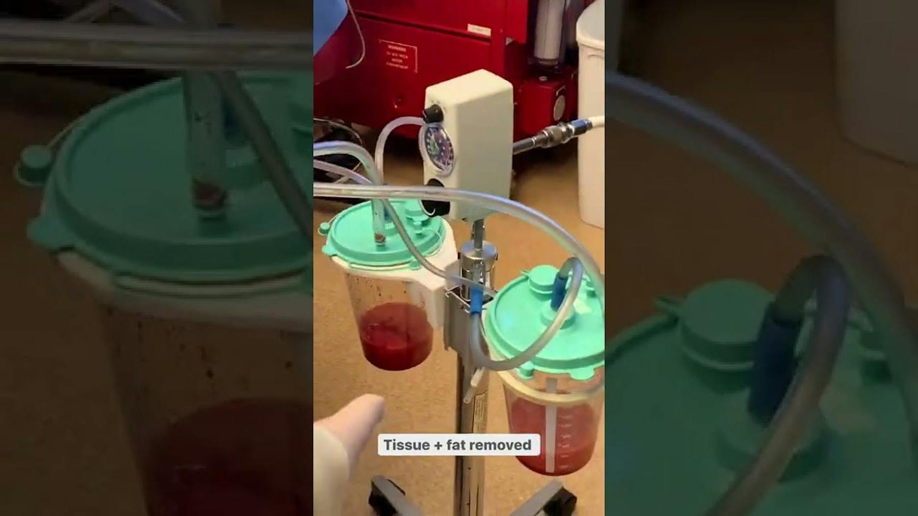 Colorado Plastic Surgery Center