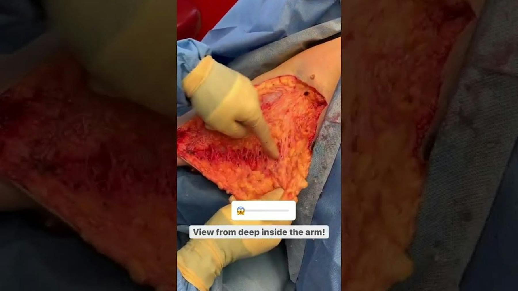 Colorado Plastic Surgery Center