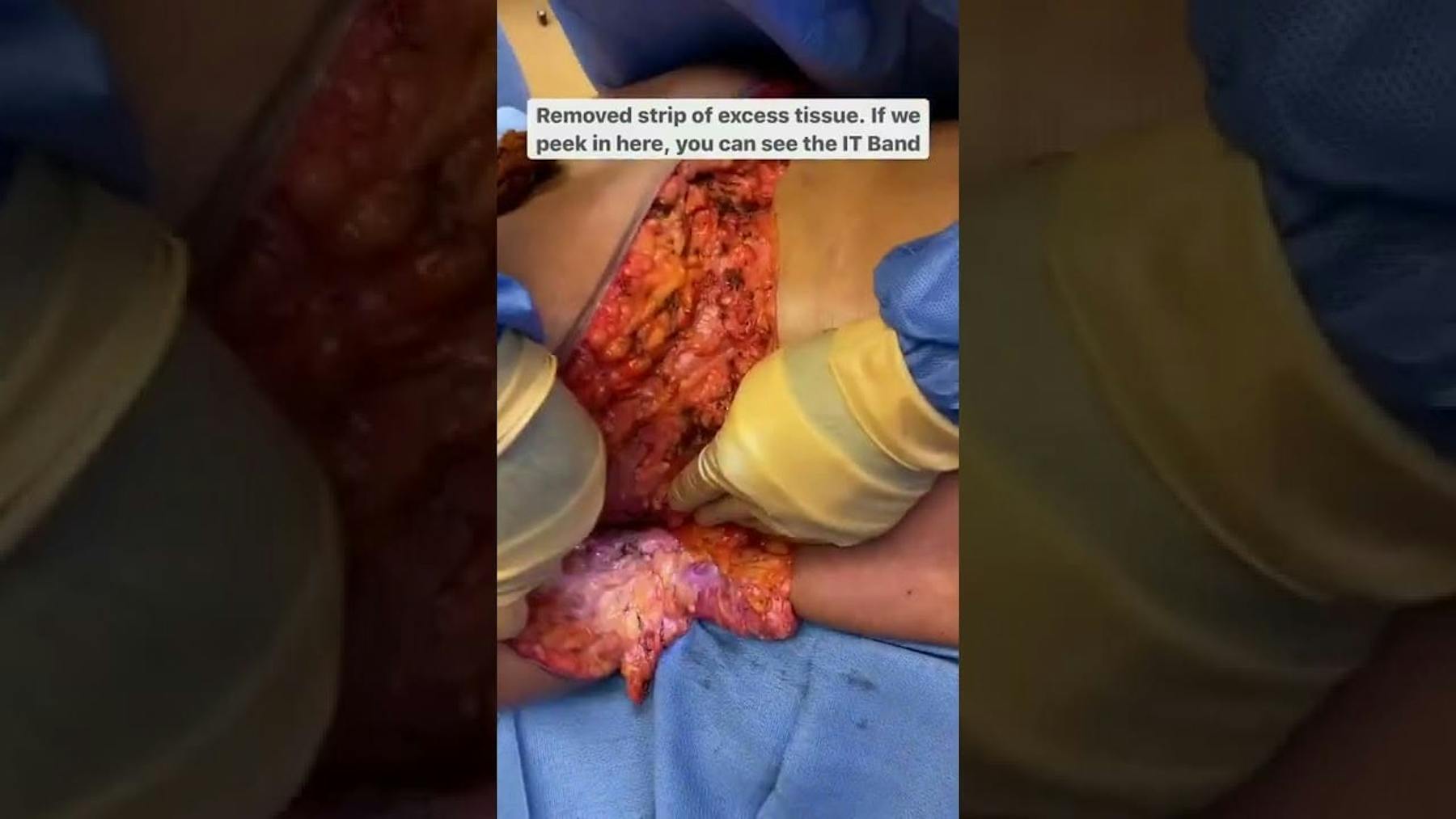 Colorado Plastic Surgery Center