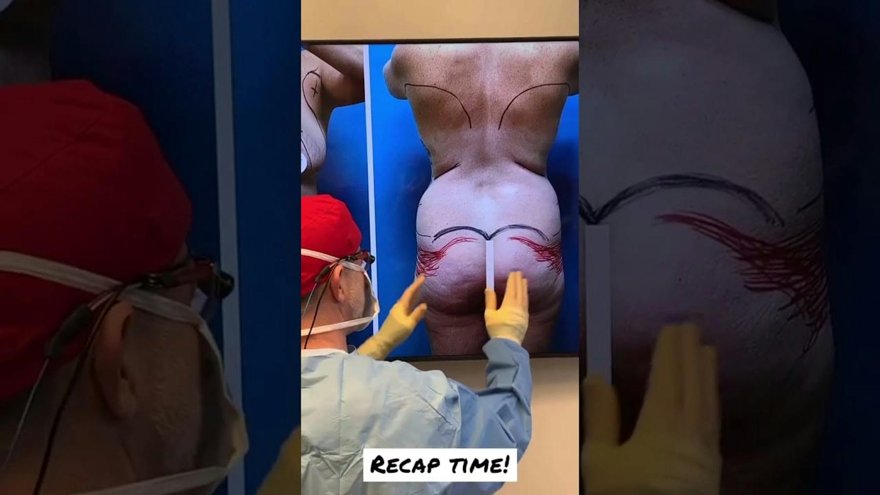 Colorado Plastic Surgery Center