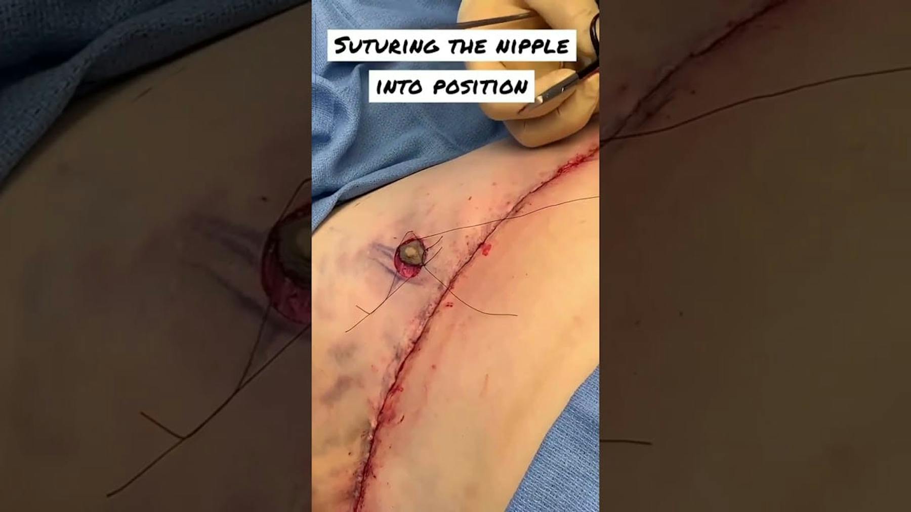 Colorado Plastic Surgery Center