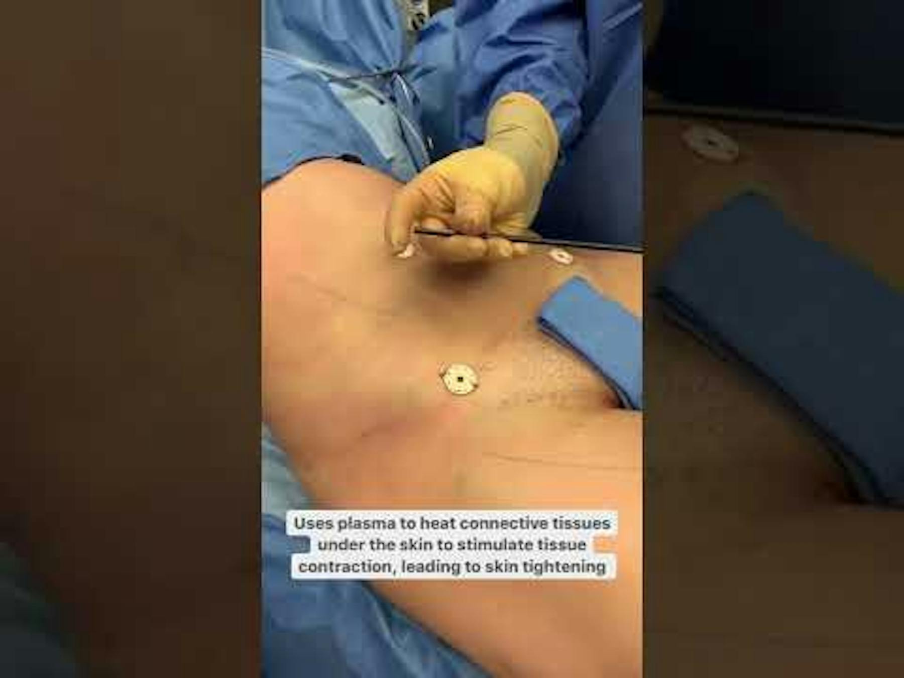 Colorado Plastic Surgery Center