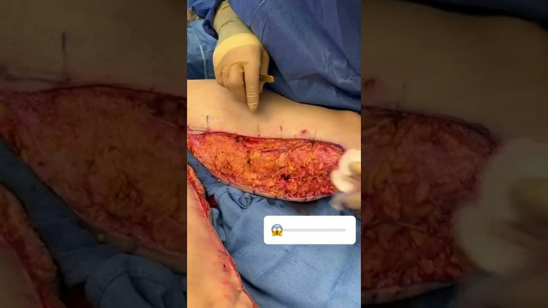 Colorado Plastic Surgery Center