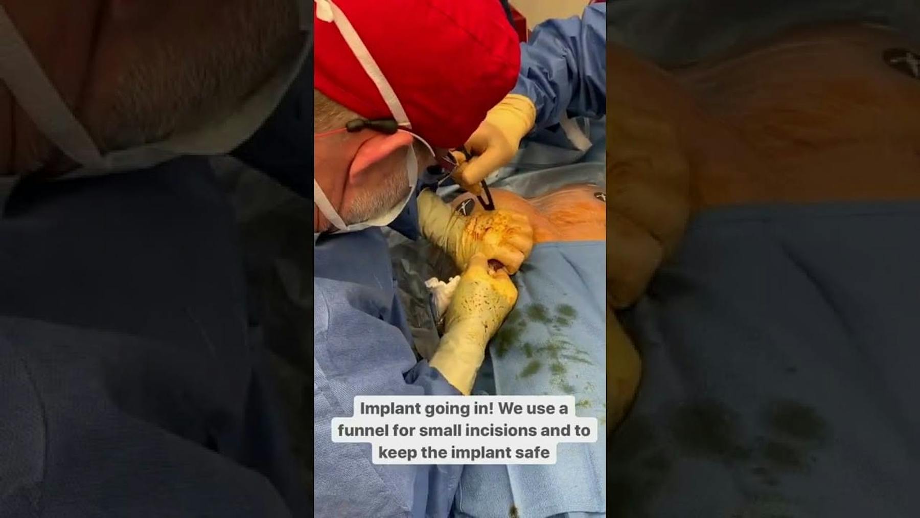 Colorado Plastic Surgery Center