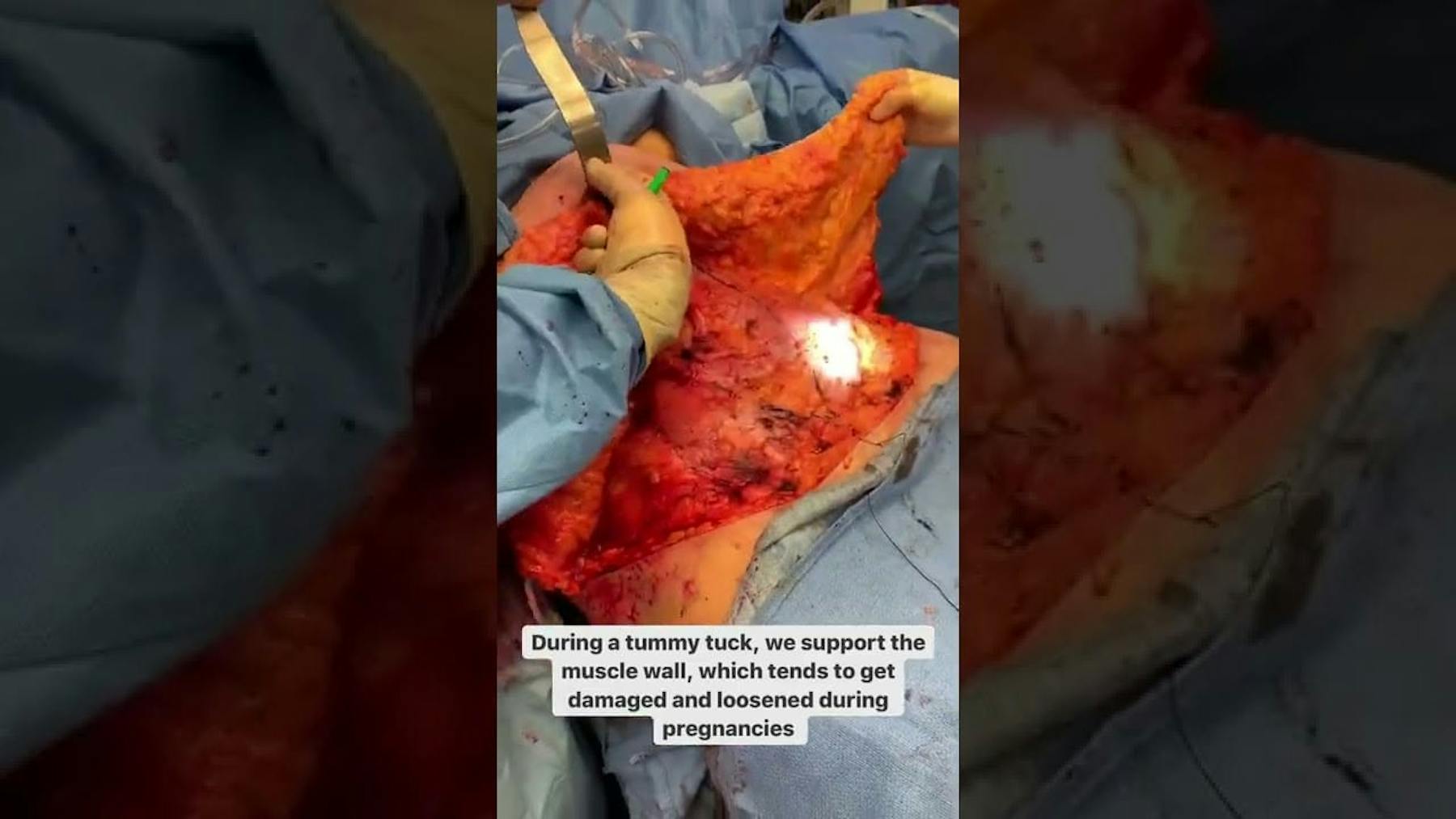 Colorado Plastic Surgery Center