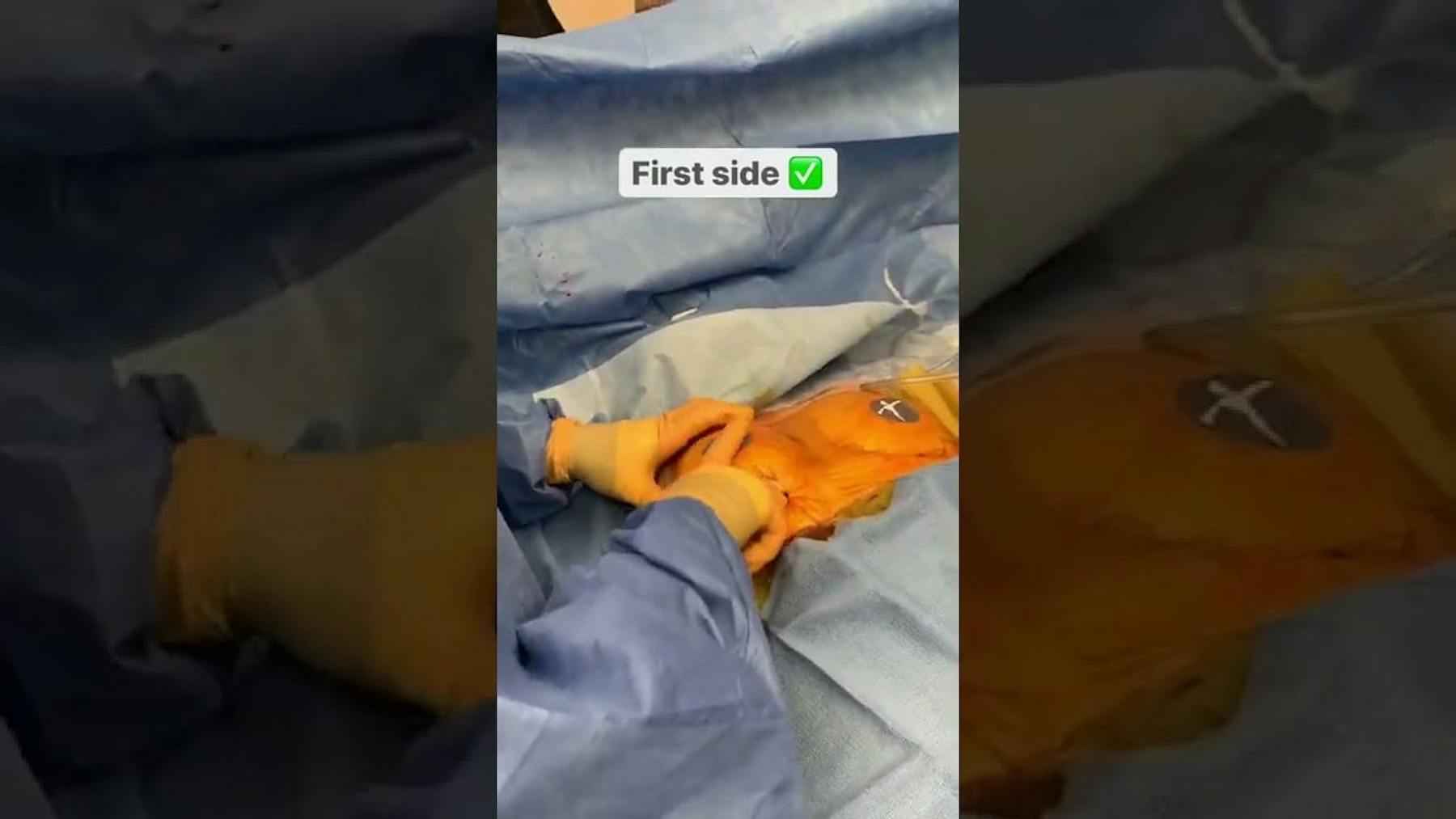 Colorado Plastic Surgery Center