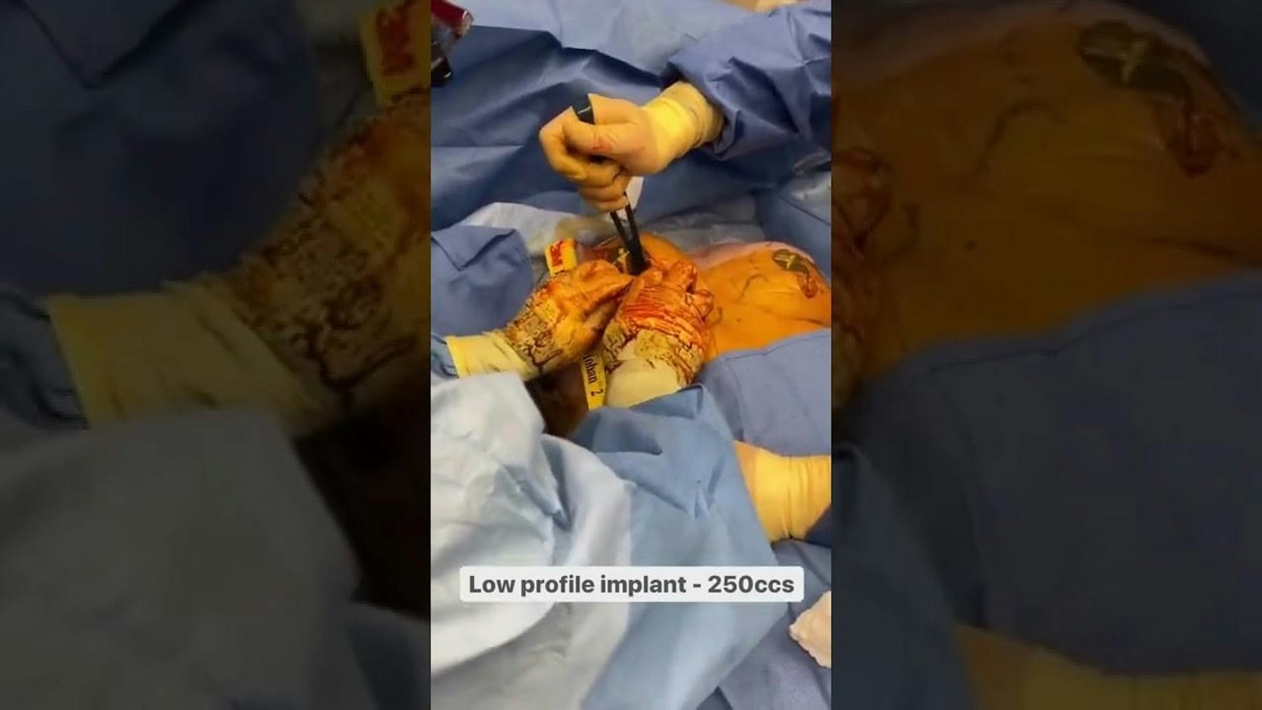 Colorado Plastic Surgery Center