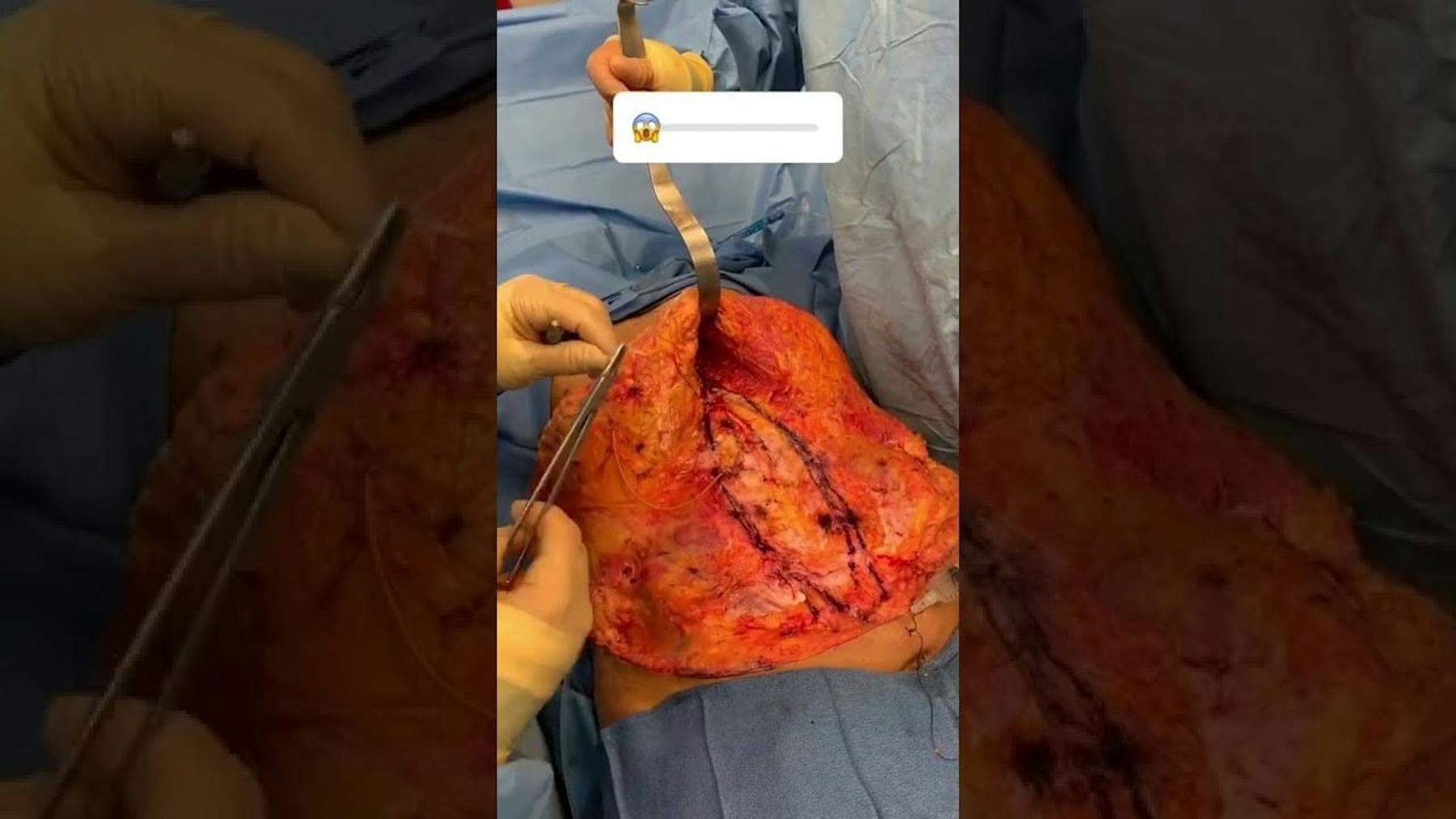 Colorado Plastic Surgery Center