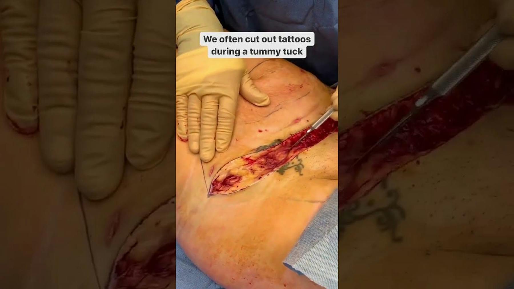 Colorado Plastic Surgery Center