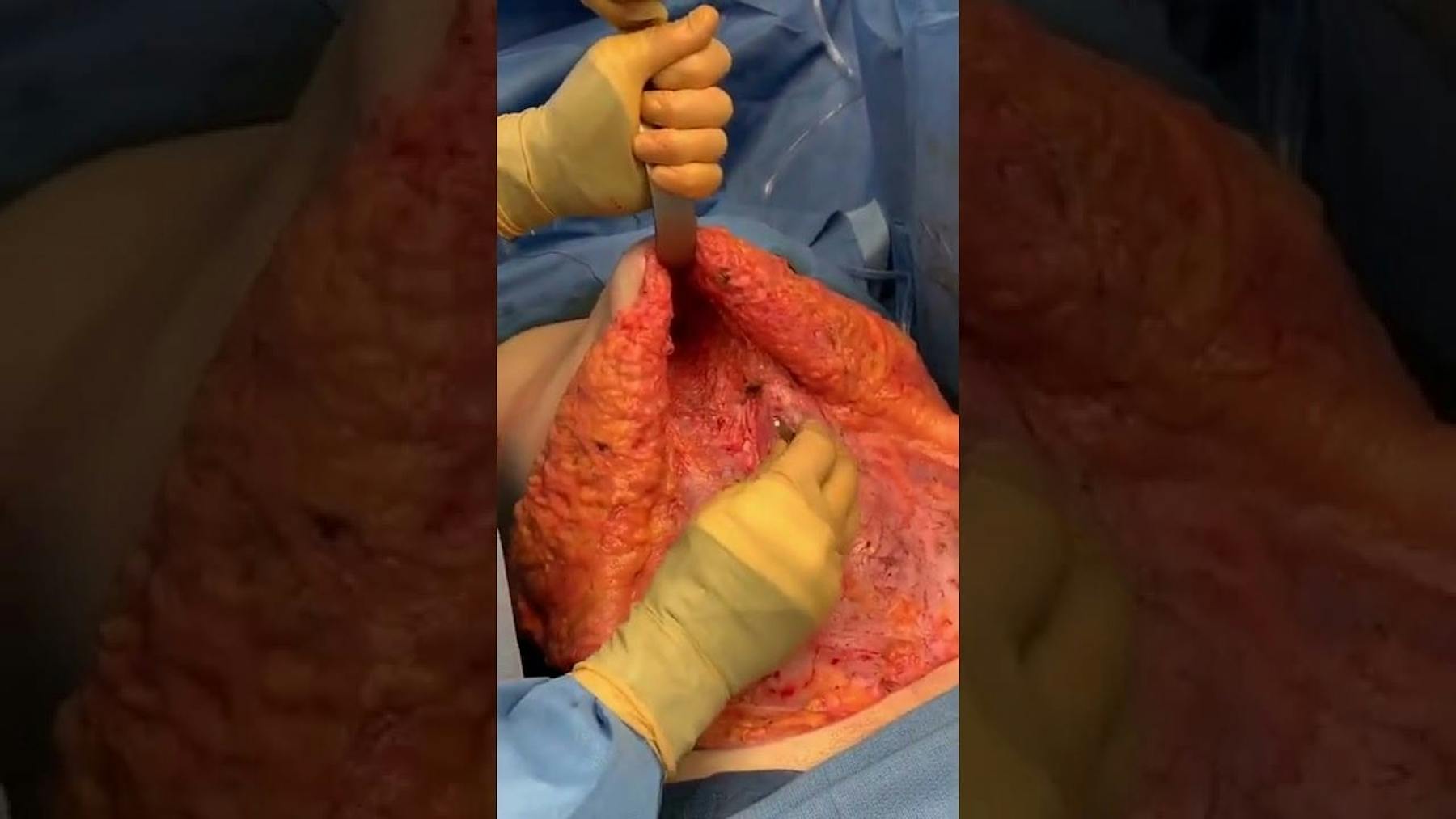 Colorado Plastic Surgery Center