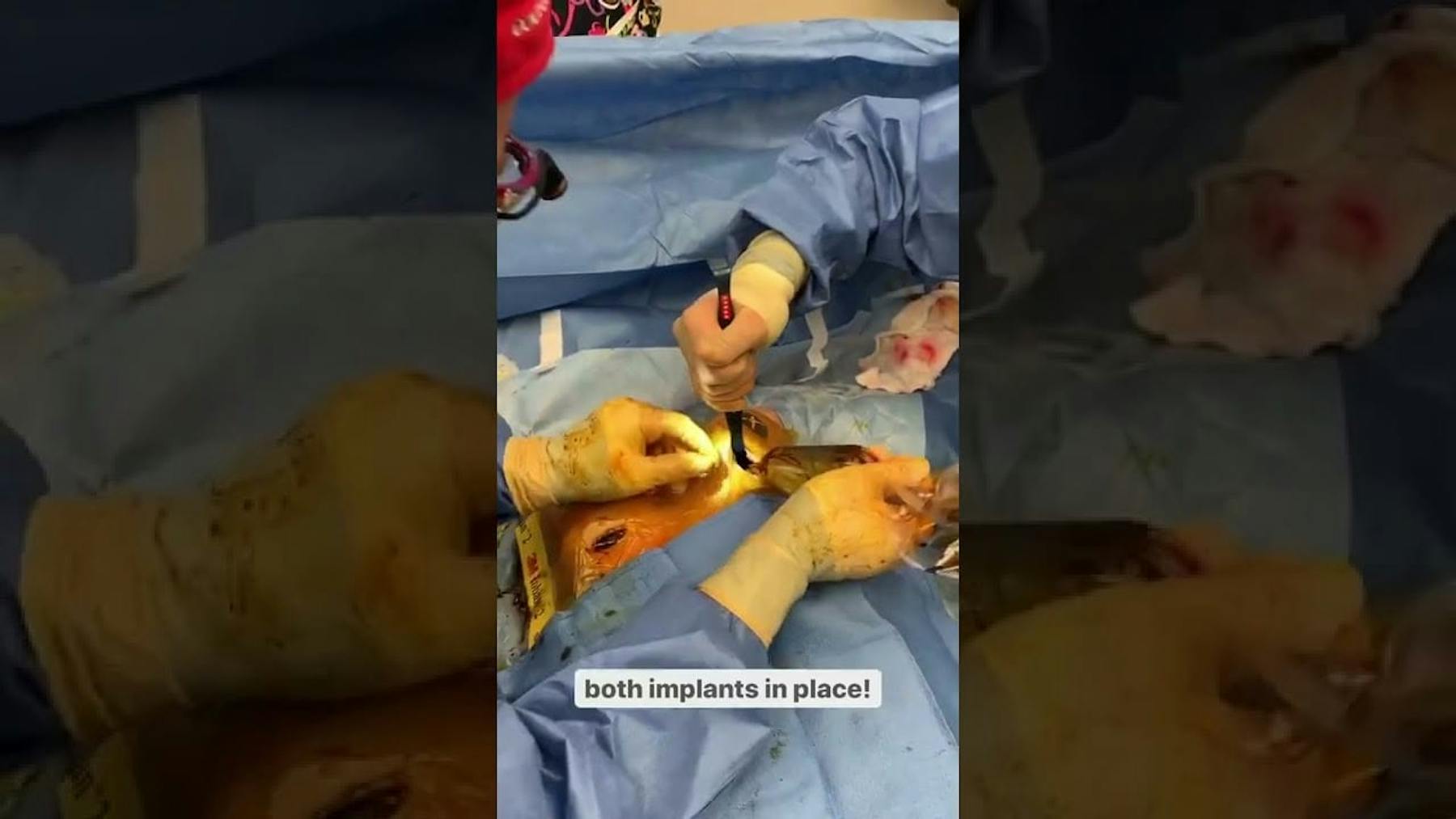 Colorado Plastic Surgery Center