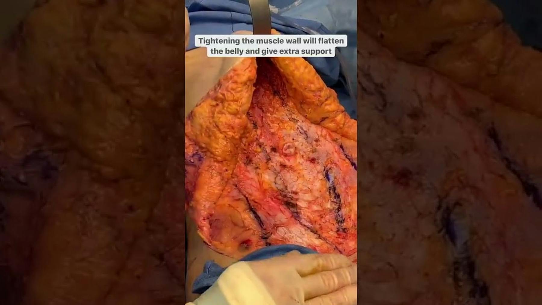 Colorado Plastic Surgery Center