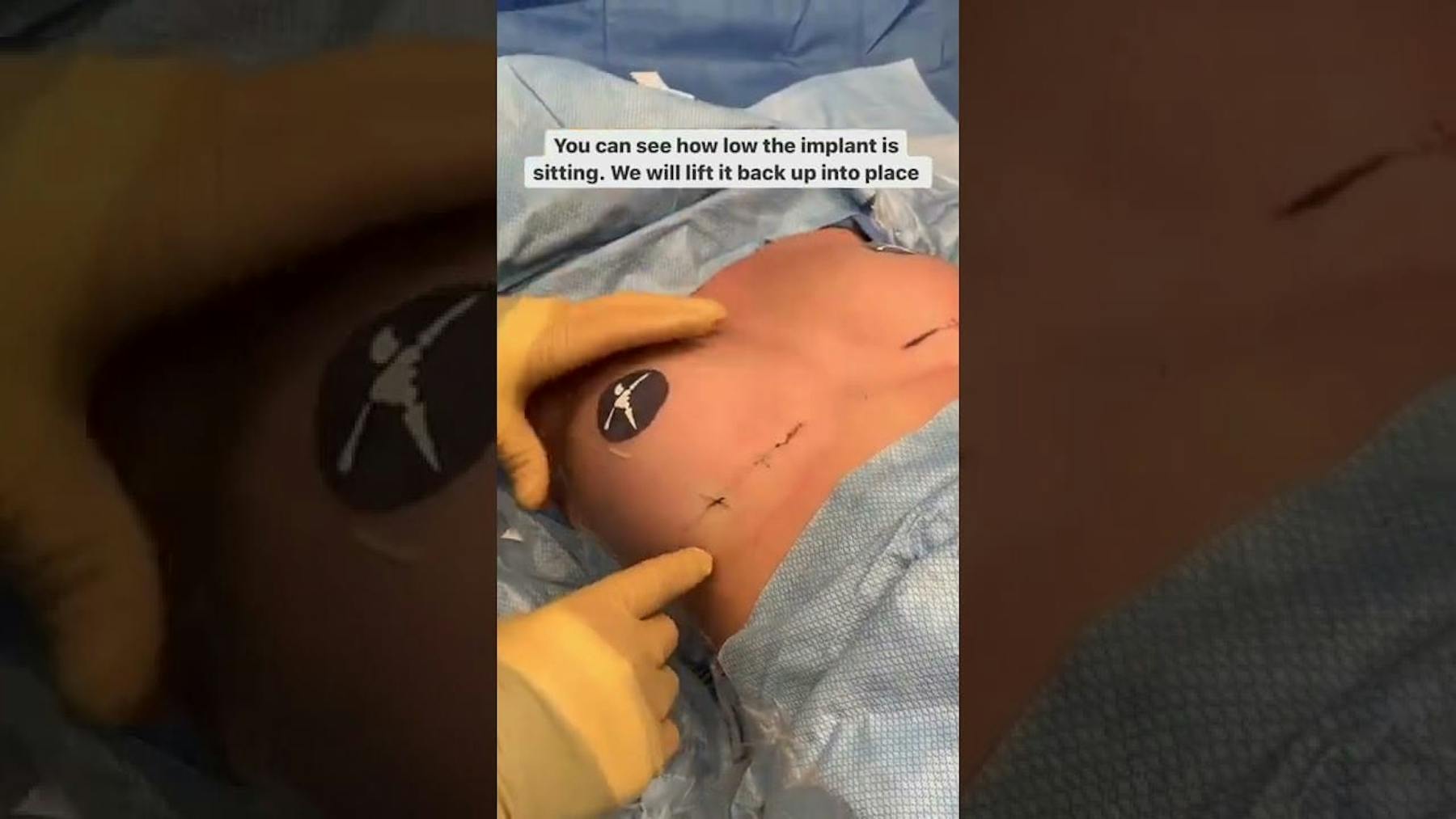 Colorado Plastic Surgery Center