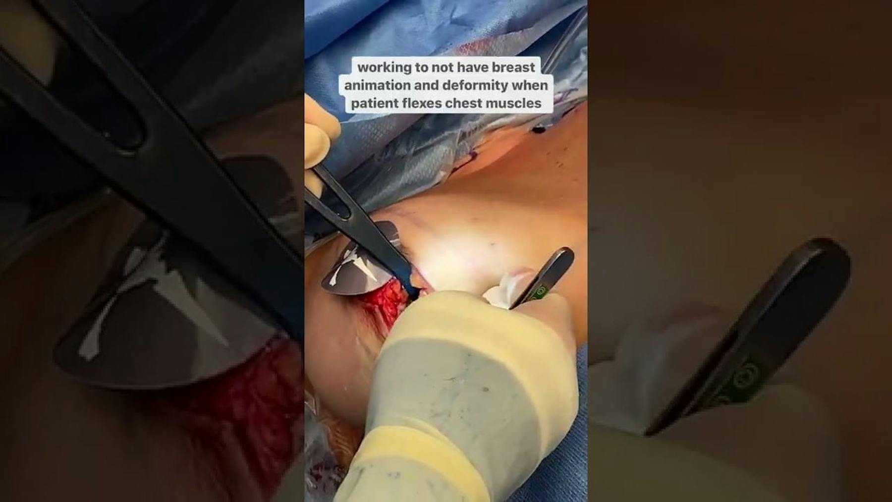 Colorado Plastic Surgery Center