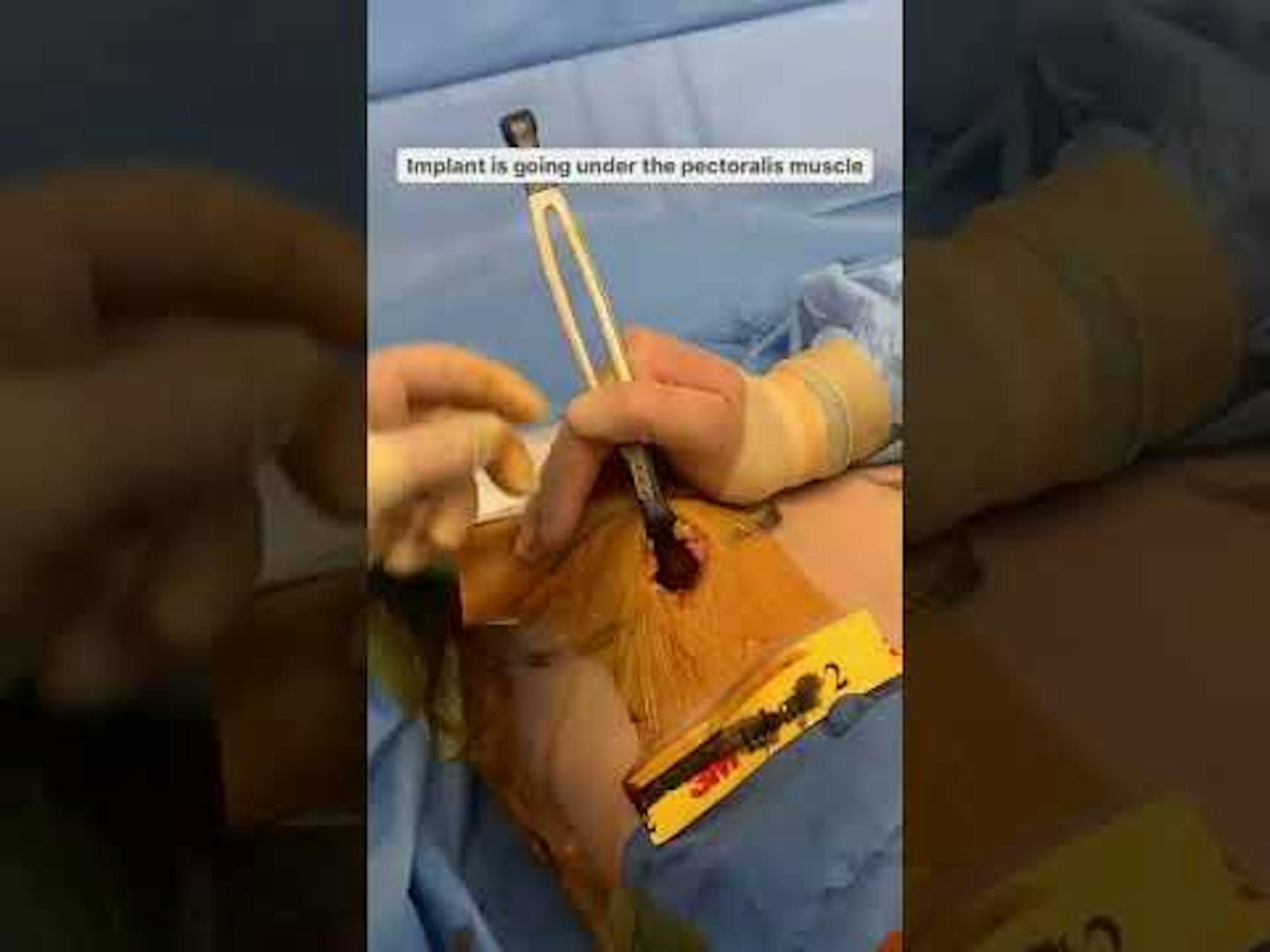 Colorado Plastic Surgery Center