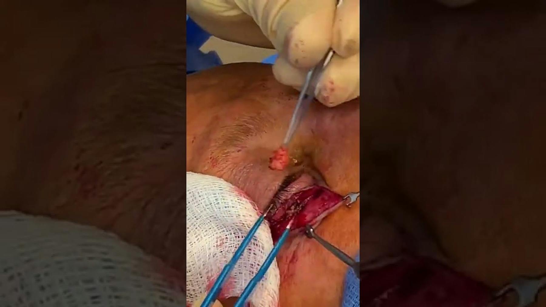 Colorado Plastic Surgery Center