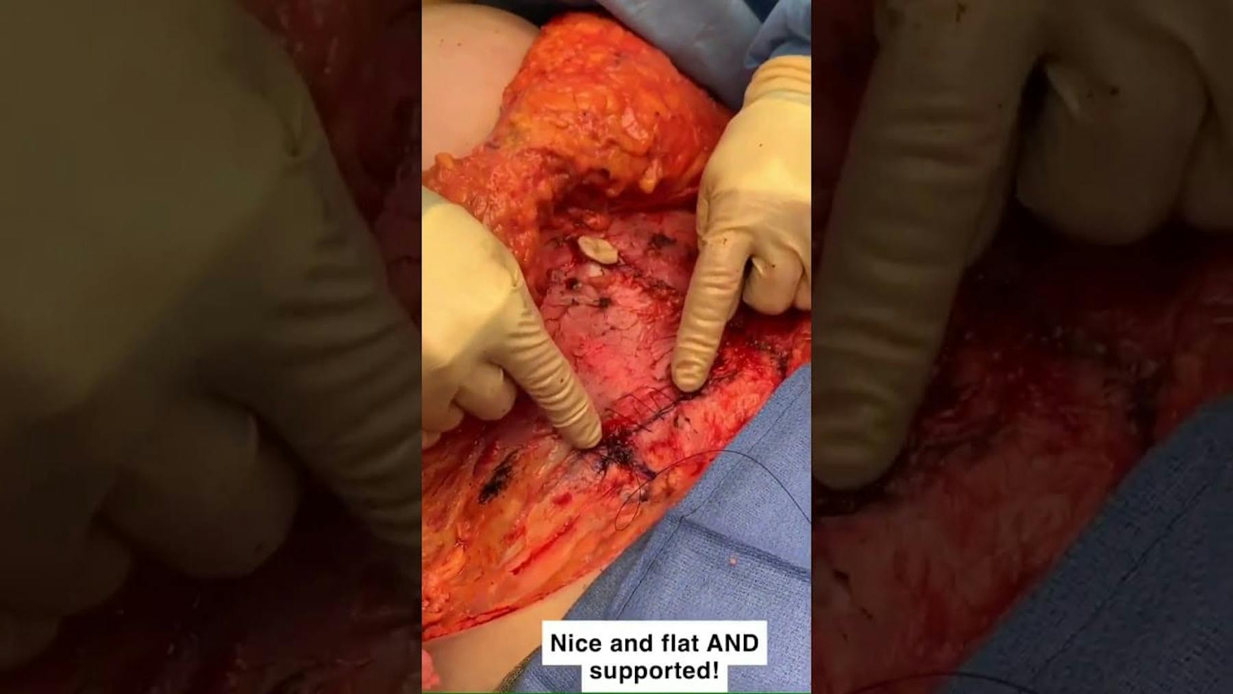 Colorado Plastic Surgery Center