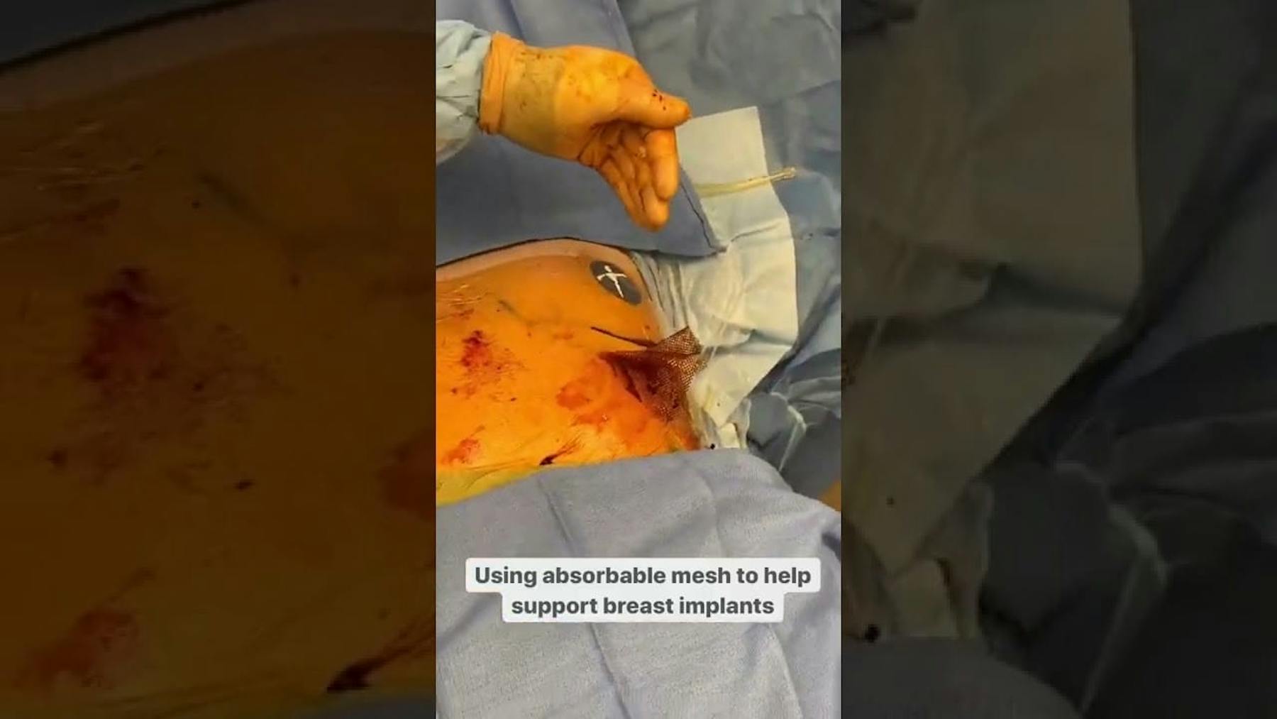 Colorado Plastic Surgery Center