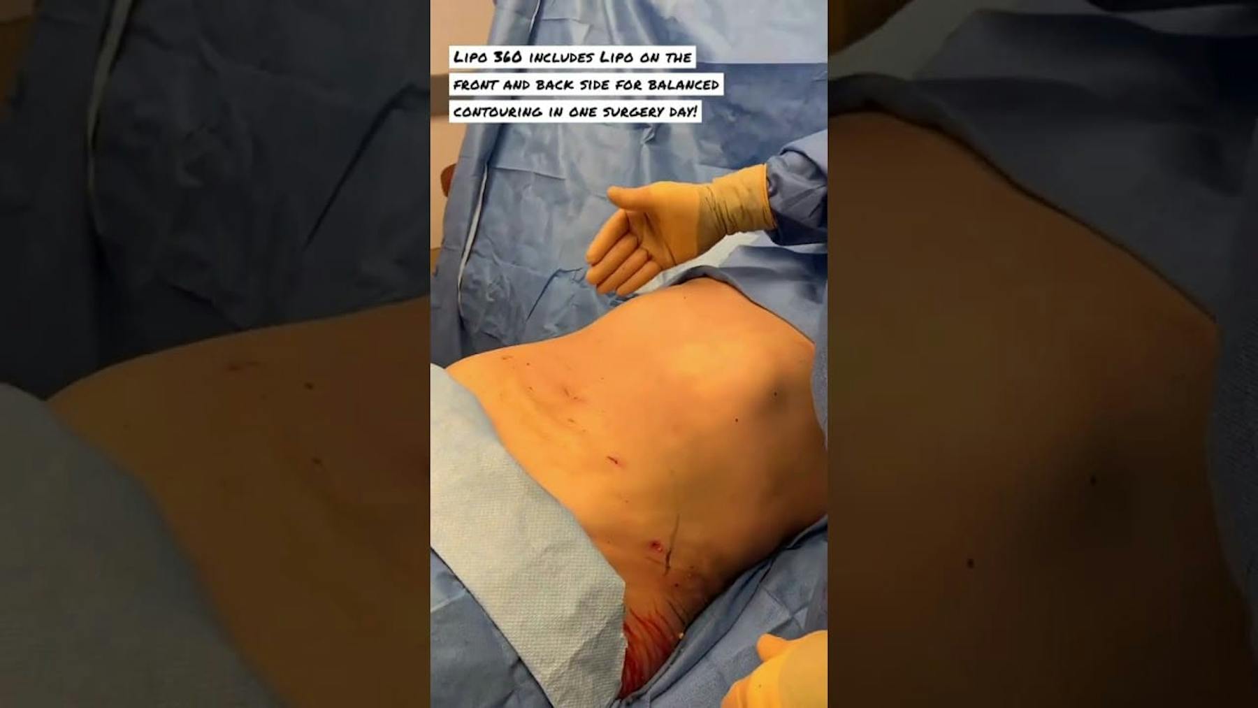 Colorado Plastic Surgery Center