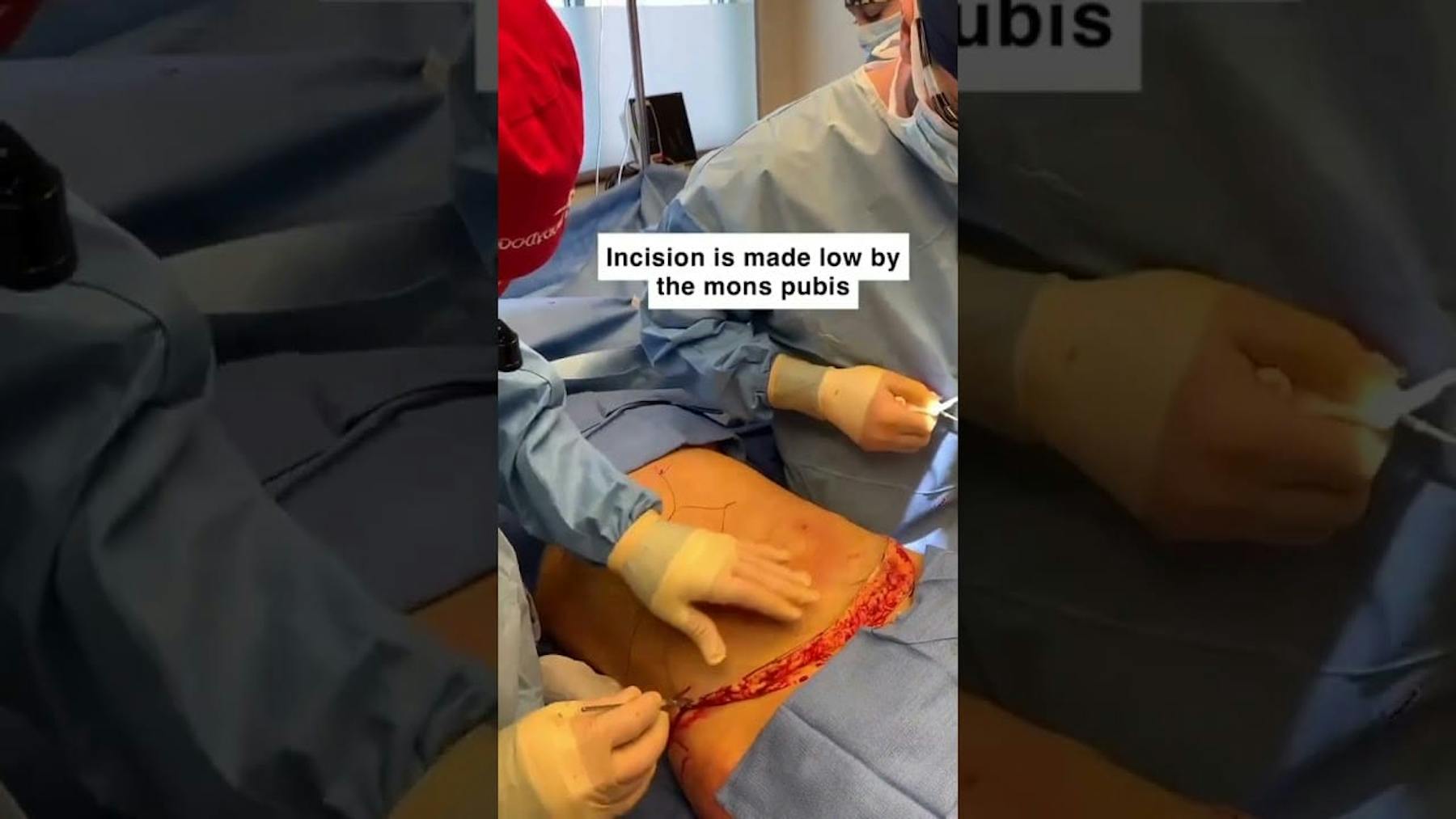 Colorado Plastic Surgery Center