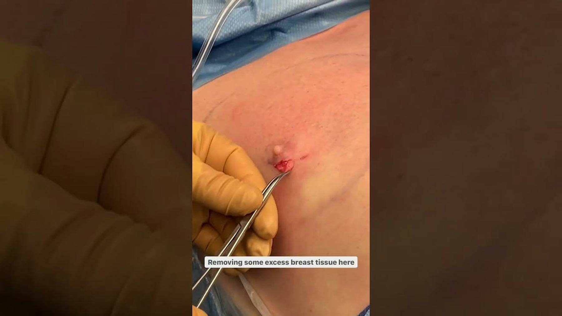 Colorado Plastic Surgery Center