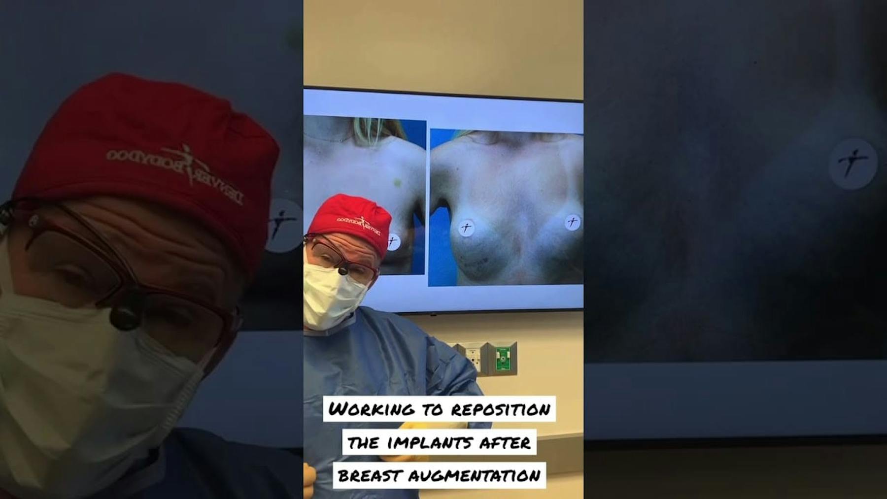 Colorado Plastic Surgery Center