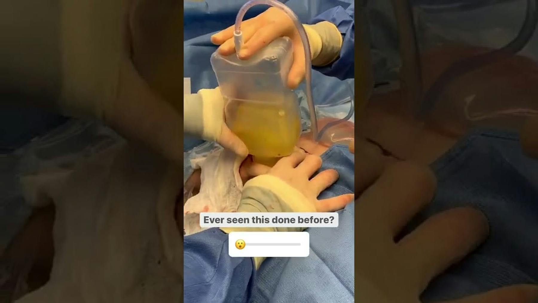 Colorado Plastic Surgery Center