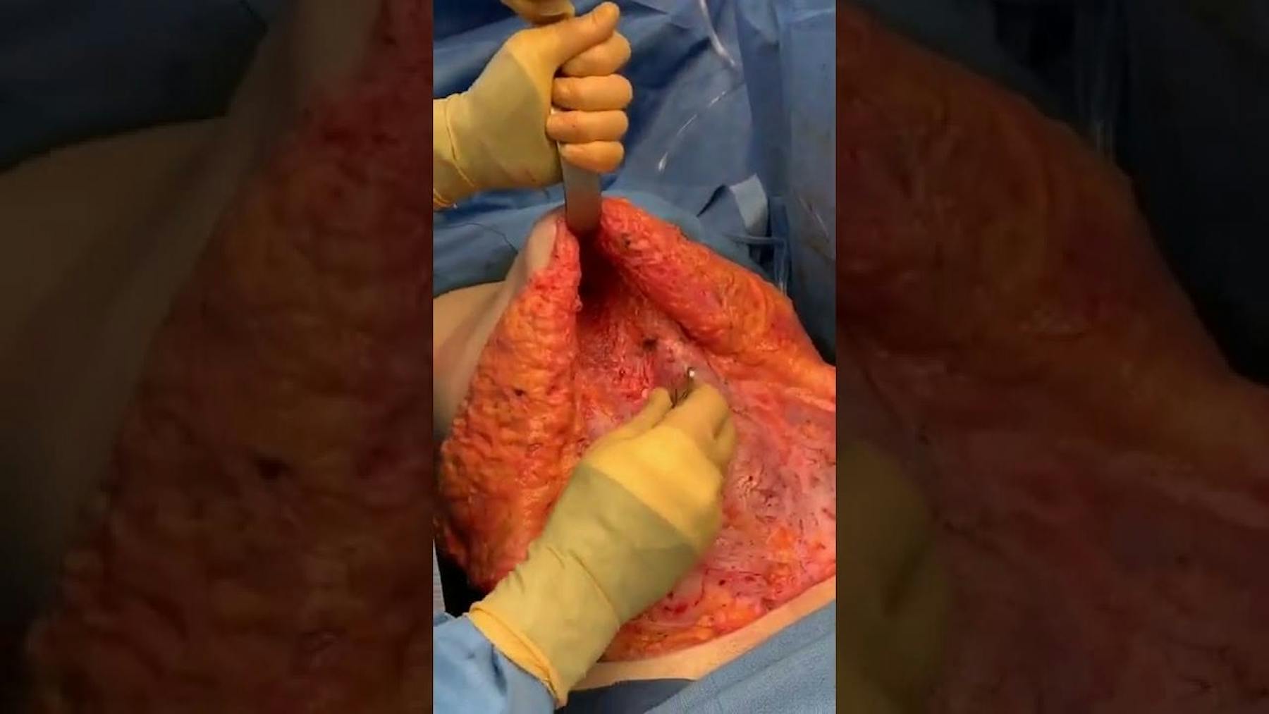 Colorado Plastic Surgery Center