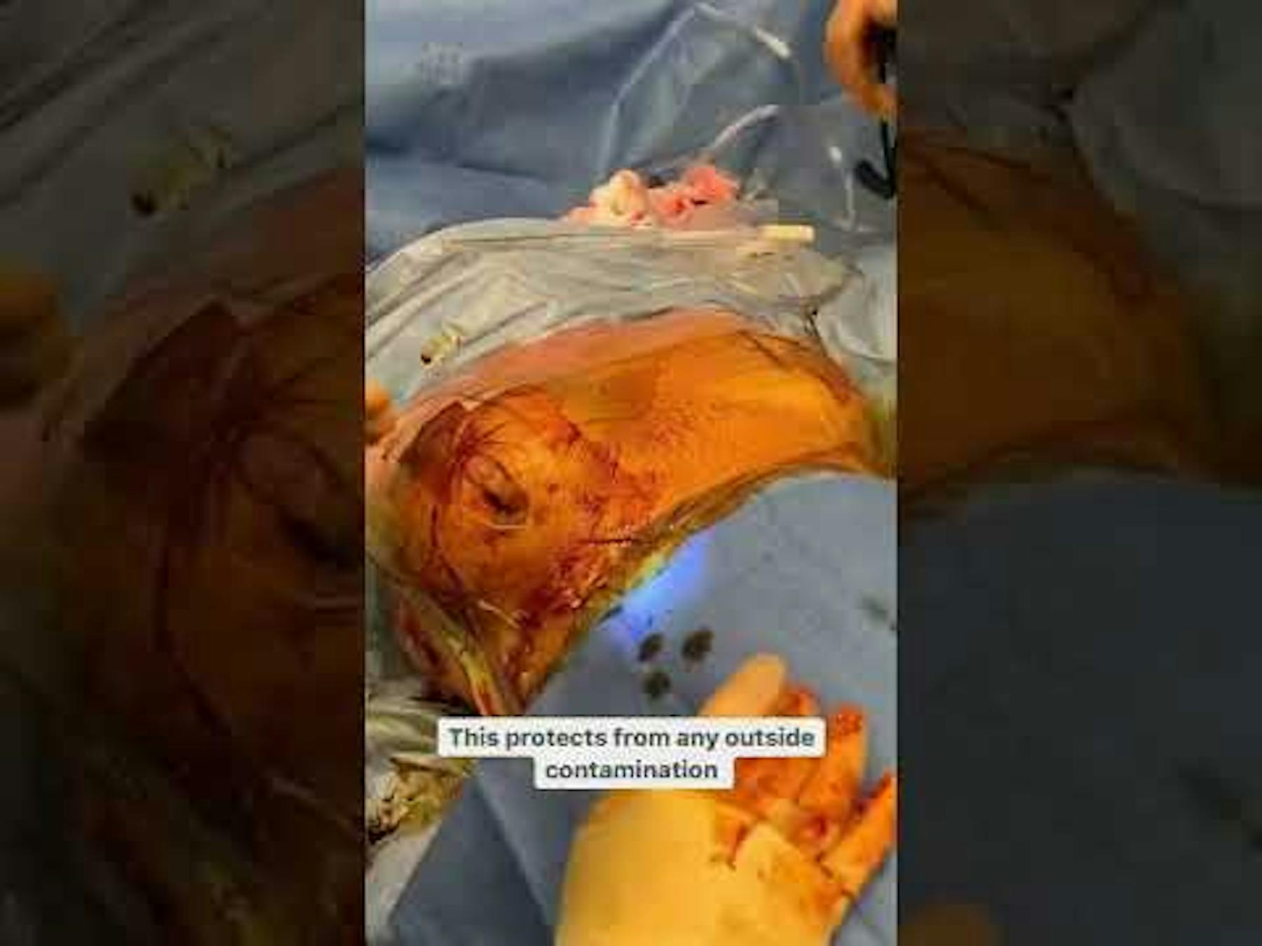 Colorado Plastic Surgery Center